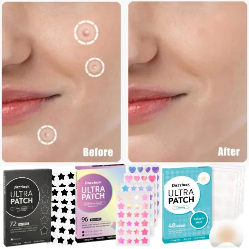 Ultra Pimple Patches with Salicylic Acid: How Hydrocolloid Spot ...